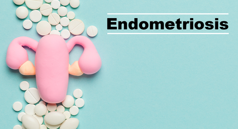 Ayurvedic Management of Endometriosis