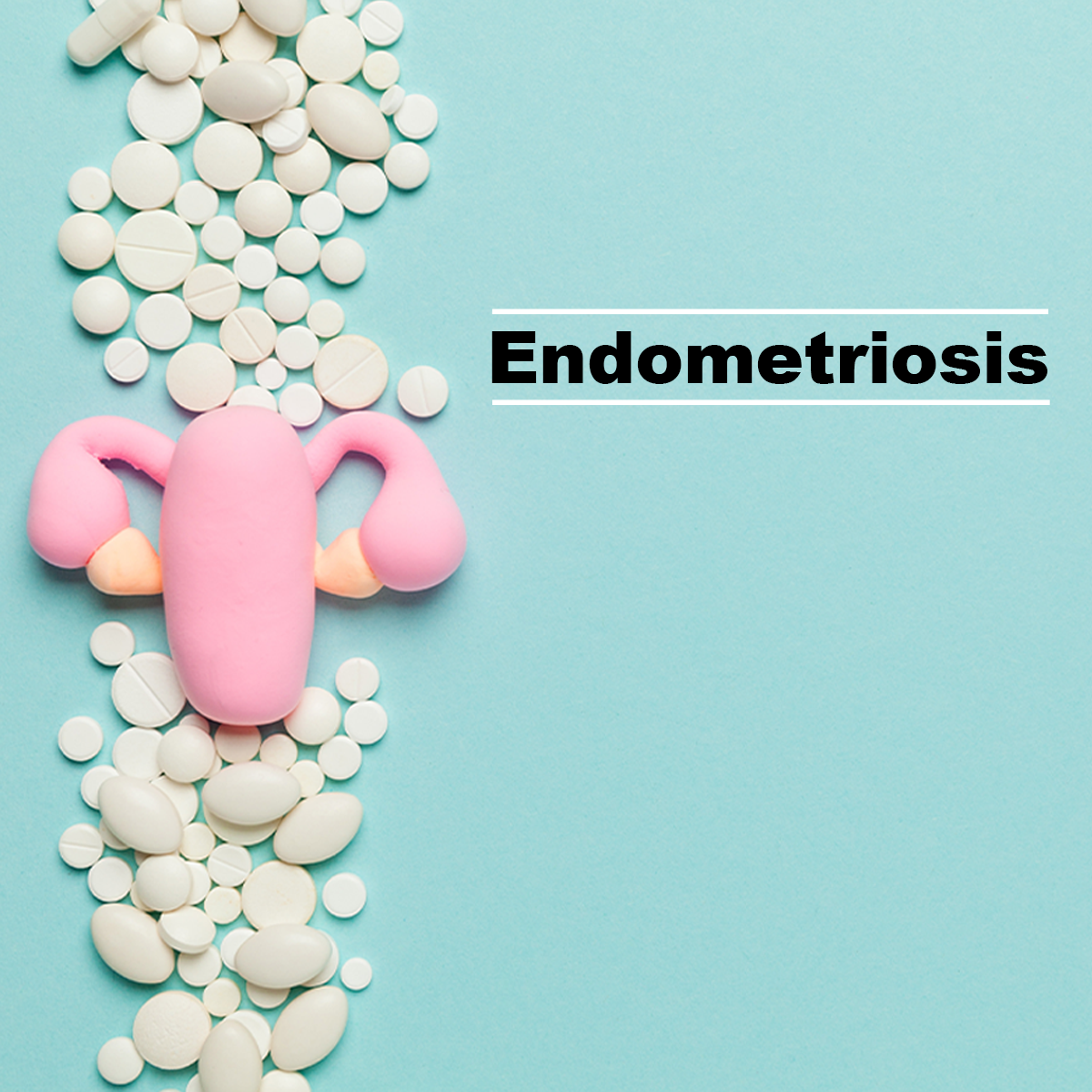 Ayurvedic Management of Endometriosis
